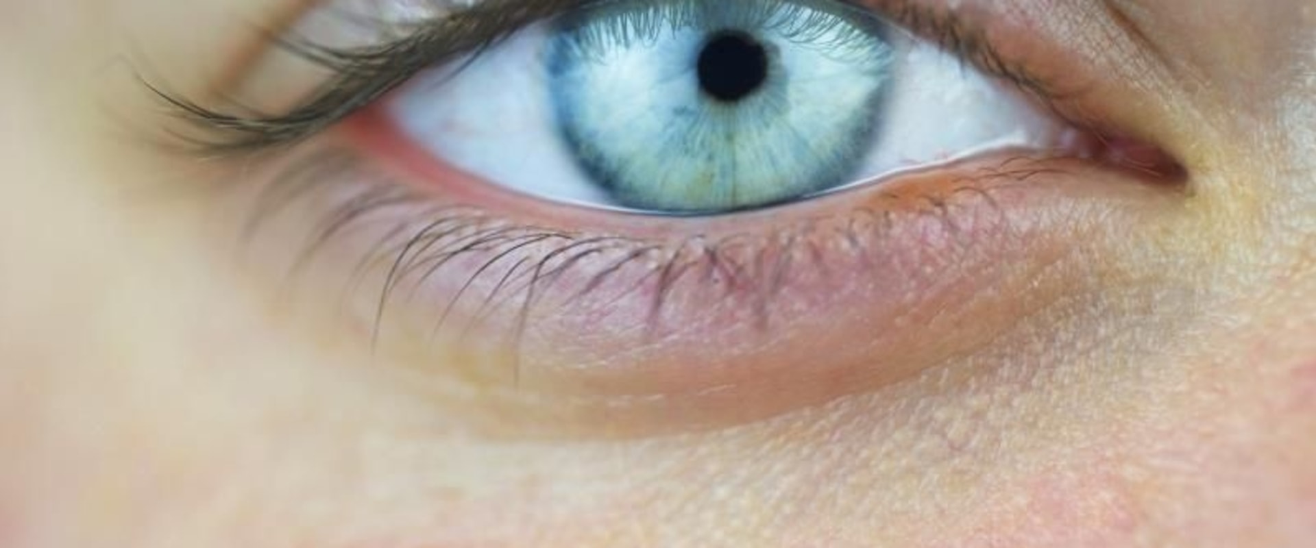 The 10 Most Common Eye Problems and How to Treat Them