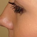 Will Eyelashes Grow Back After Being Pulled Out?