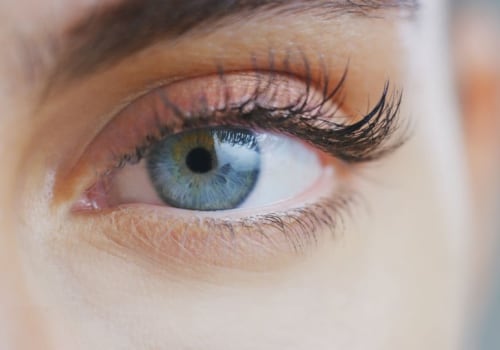 Do Eyelash Extensions Ruin Your Natural Lashes?