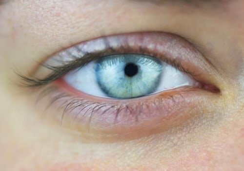 The 10 Most Common Eye Problems and How to Treat Them